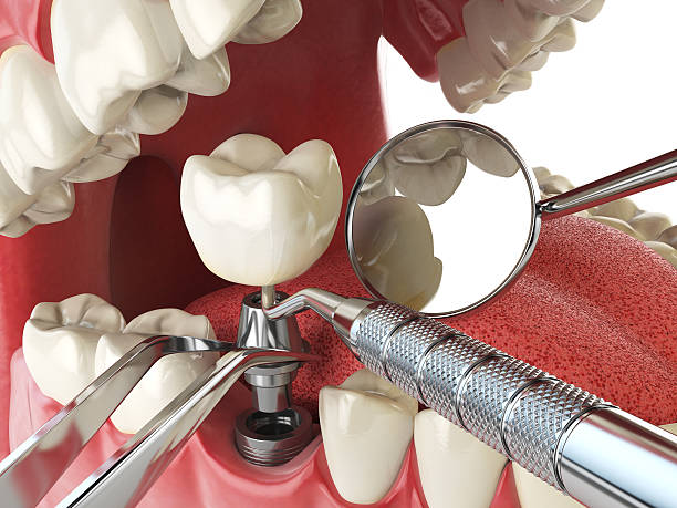 Best Emergency Denture Repair in Jasper, TN